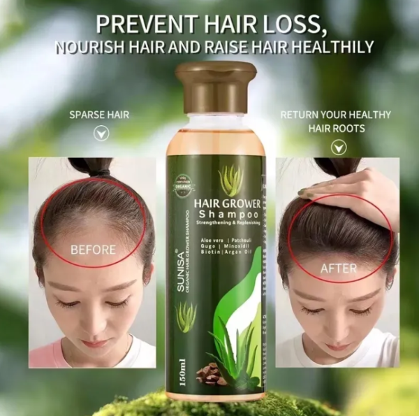 Sunisa Aloe Vera Hair Growth Shampoo - Image 3
